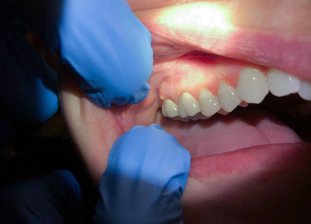 Best Cosmetic Emergency Dentistry in Fort Leonard Wood, MO